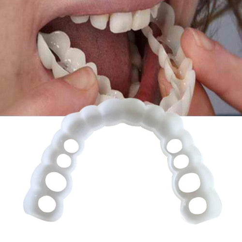 Facetas OdontolÃ³gicas RemovÃ­veis - Snap On Smile
