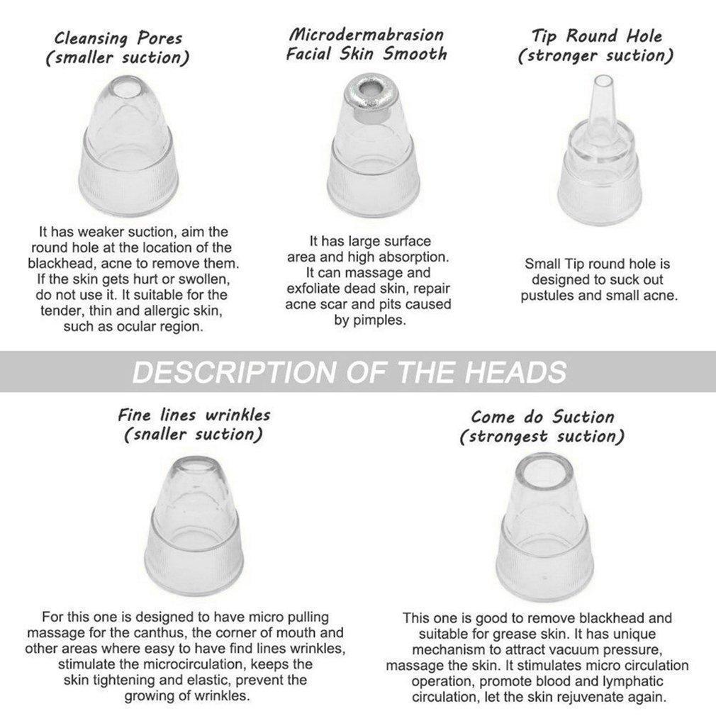 Aparelho Removedor de Cravos a VÃ¡cuo - ExtraÃ§Ã£o por SucÃ§Ã£o