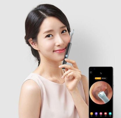 EndoscÃ³pio Bebird Mini CÃ¢mera 300W Auricular